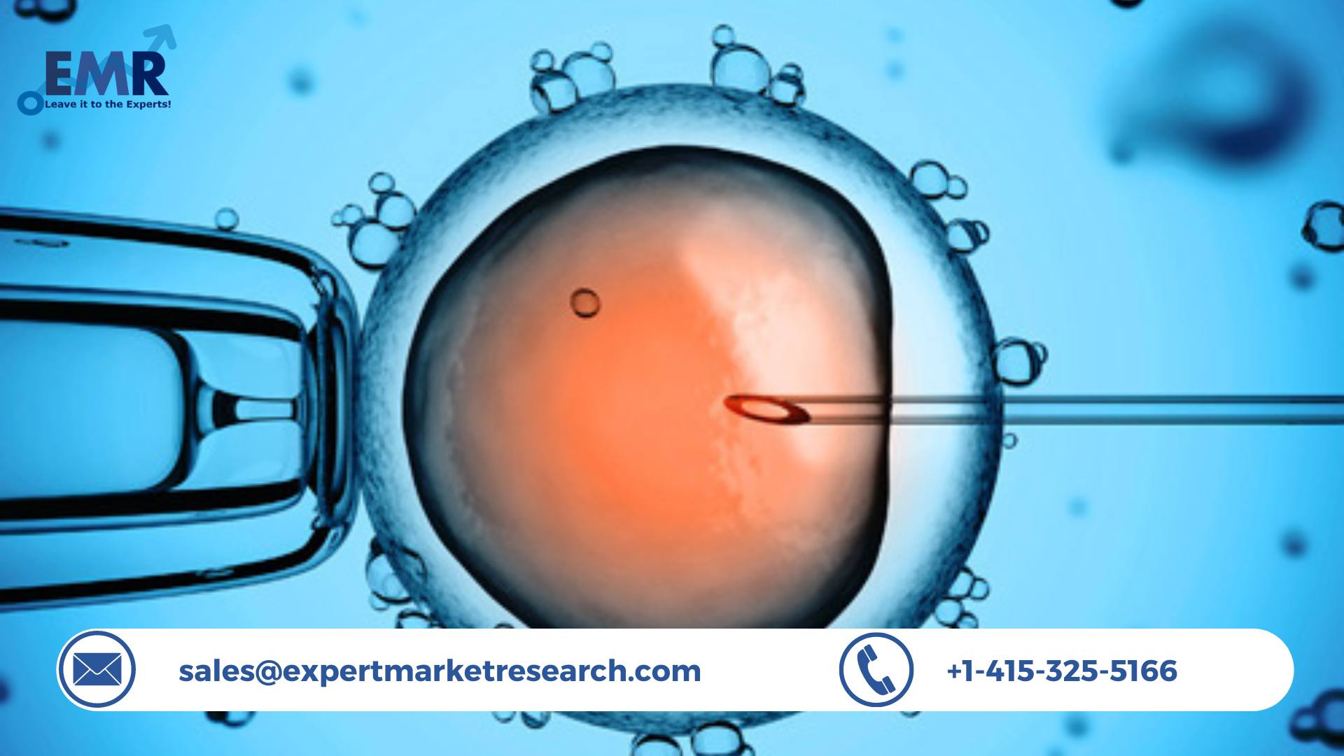 Assisted Reproductive Technology Market Share