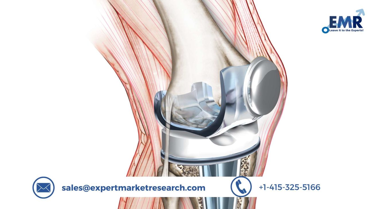 Knee Replacement Market Share