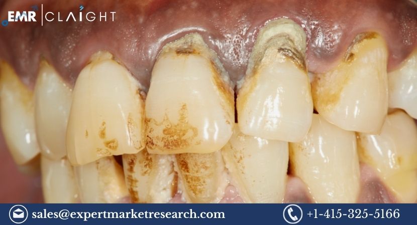 Periodontal Therapeutics Market