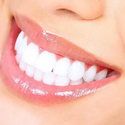 Teeth Whitening Aberdeen